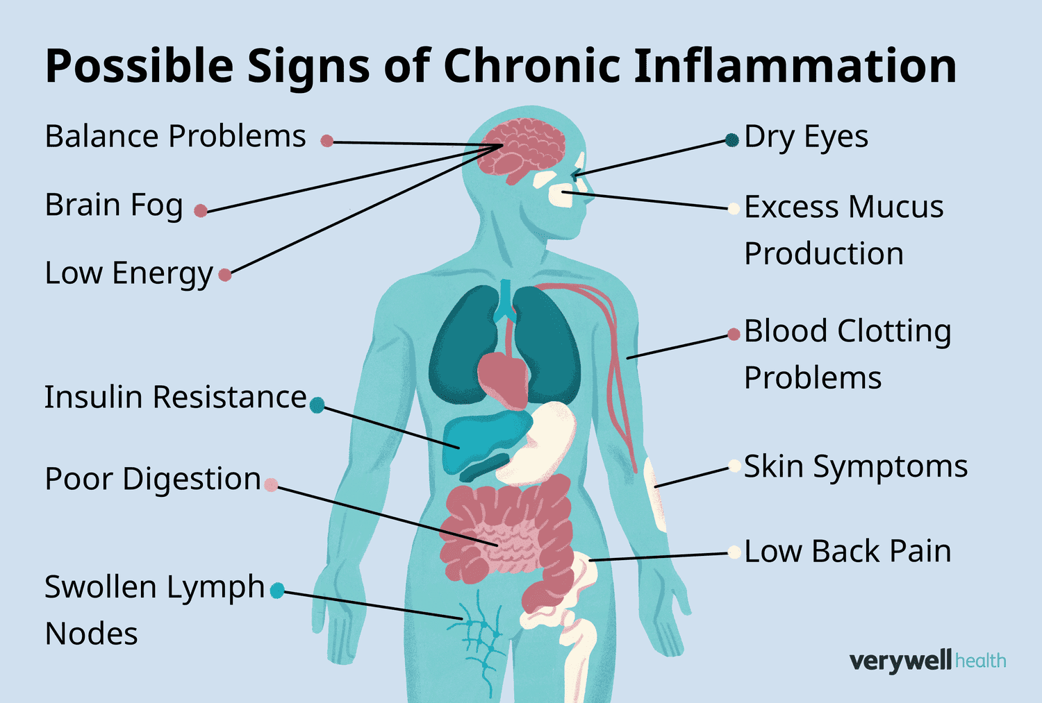 11-atypical-signs-of-chronic-inflammation-5075765-FINAL-4-f5725e25e0764536876de79bceb3bb71