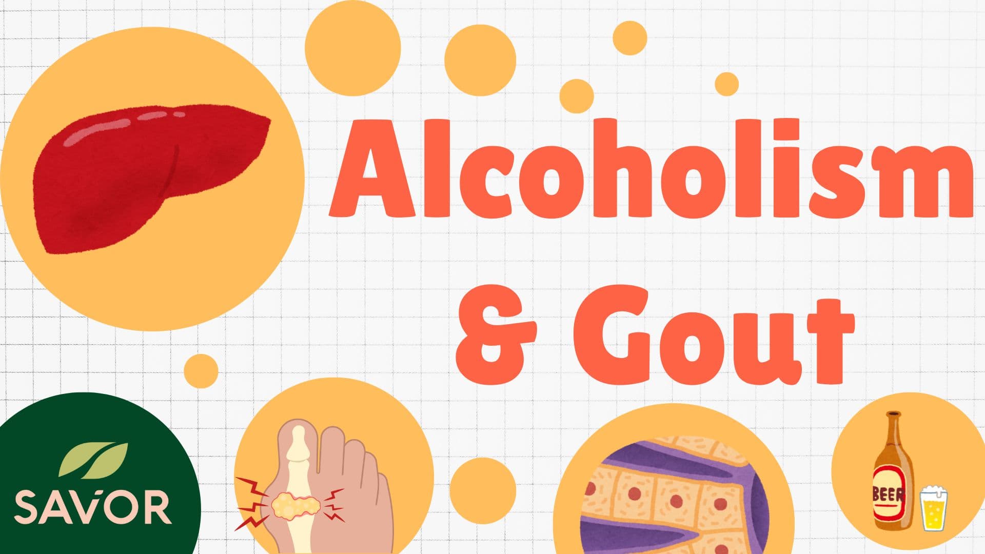 Alcoholism & Gout